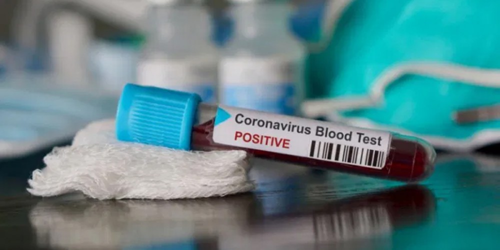 Coronavirus, sono venti i casi a Palma Campania